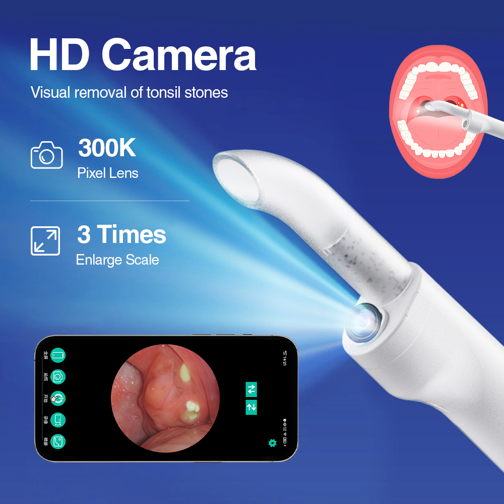 スマートビジュアル扁桃石除去キット内蔵LEDライト付き可視扁 - Lighting Visual のレビューと価格