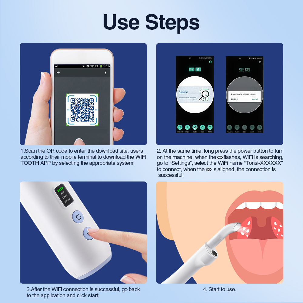 スマートビジュアル扁桃石除去キット内蔵LEDライト付き可視扁 - Lighting Visual のレビューと価格